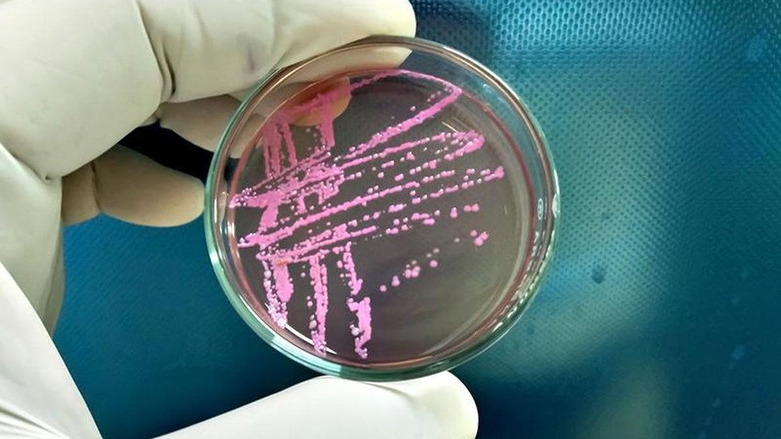 Microscopic image of Shigella bacteria, rod-shaped and gram-negative, causing shigellosis